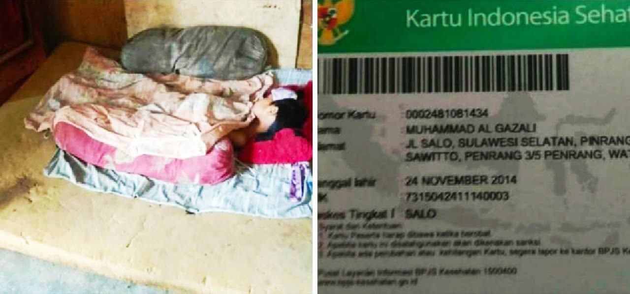 Sempat Terlantar, Seorang Anak Di Pinrang Kini Telah Dirawat Setelah Mendapat Bantuan Wagub Sulsel