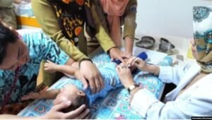 Kasus Hepatitis Akut Naik Jadi 16 Kasus, Bagaimana Orangtua Sebaiknya Merespons?