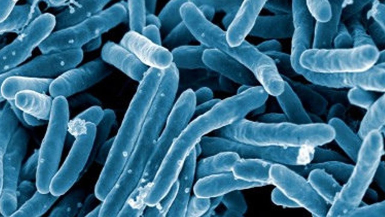 Kemiskinan dan Rentannya Penyakit Infeksi 2 A scanning electron micrograph of Mycobacterium tuberculosis bacteria