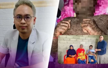 Pemuda Asal Sulawesi yang Sempat Viral Kulitnya Bersisik Usai Minum Collagen Pemutih, Ternyata Menderita Autoimun 6 Pemuda Asal Sulawesi yang Sempat Viral Kulitnya Bersisik Usai Minum Collagen Pemutih, Ternyata Menderita Autoimun