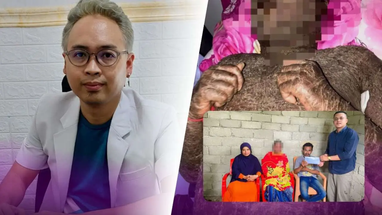 Pemuda Asal Sulawesi yang Sempat Viral Kulitnya Bersisik Usai Minum Collagen Pemutih, Ternyata Menderita Autoimun
