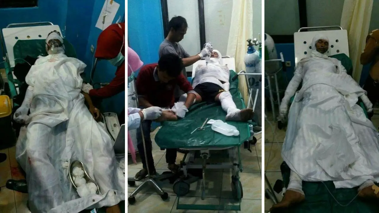 Tangki SPBU di Maros Meledak, 6 Korban Luka-Luka