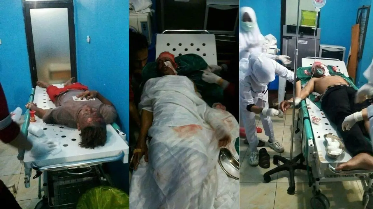 Tangki SPBU di Maros Meledak, 6 Korban Luka-Luka