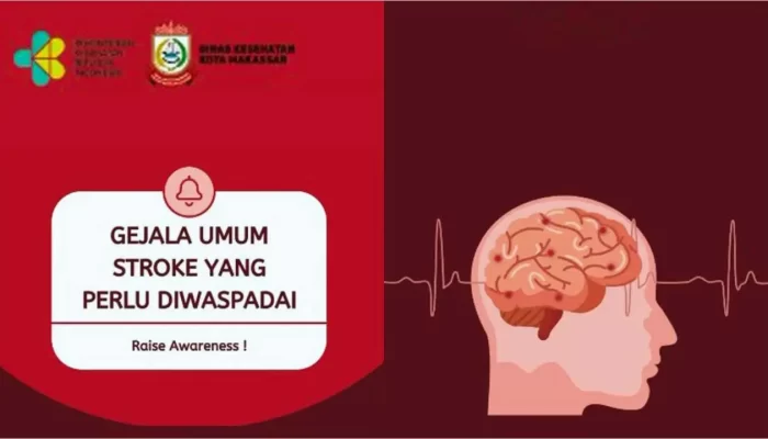 Dinas Kesehatan Kota Makassar Minta Semua Pihak Waspada Terhadap Stroke