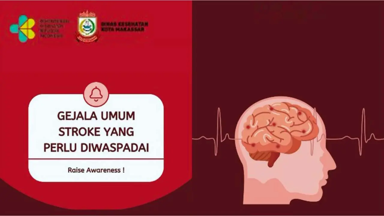 Dinas Kesehatan Kota Makassar Minta Semua Pihak Waspada Terhadap Stroke