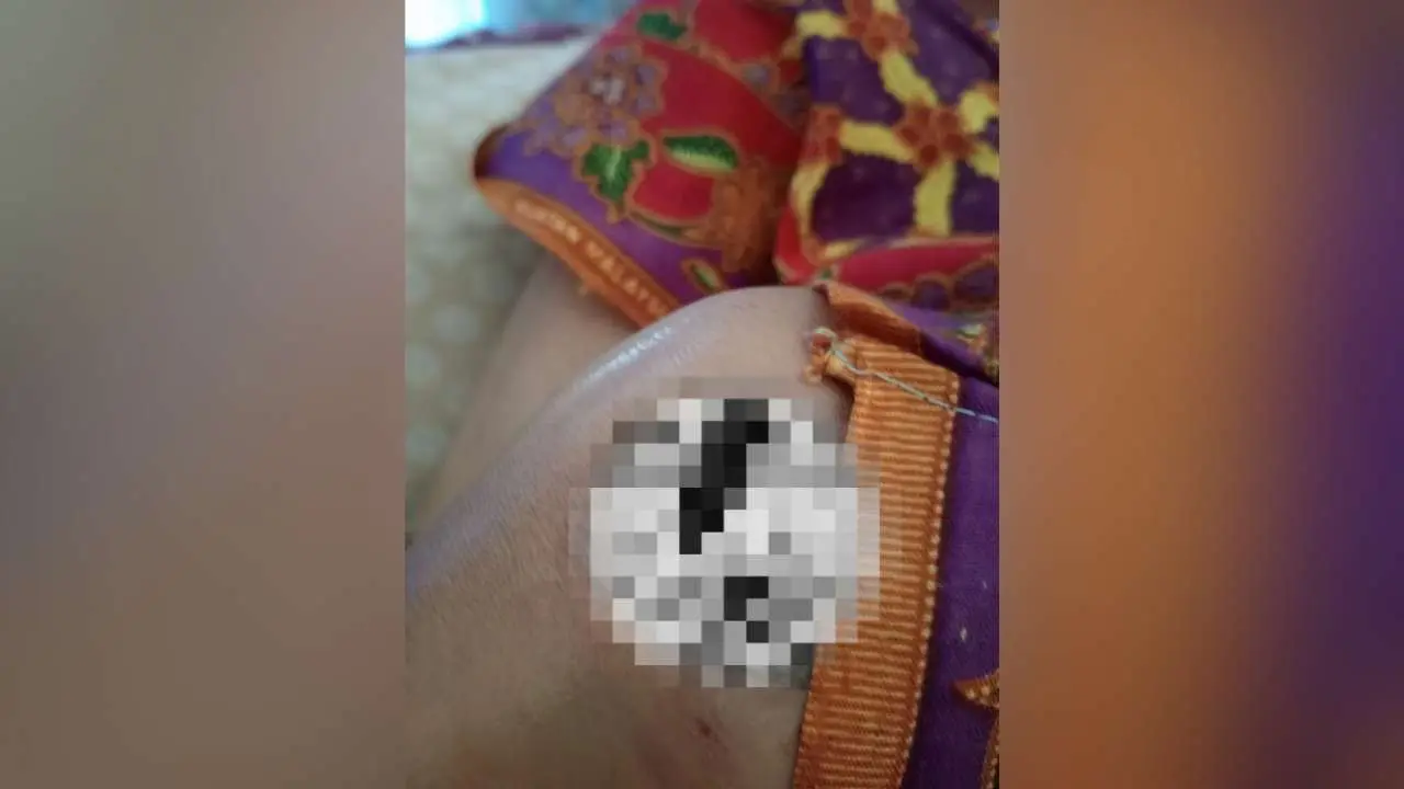 Oknum Perawat Puskesmas Binamu Kota Bersikap Kasar ke Pasien, Kapus Janji Beri Sanksi Tegas