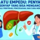 Batu Empedu: Penyakit Senyap yang Bisa Mengancam, Kenali Penyebab, Pencegahan, dan Cara Mengobati